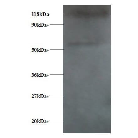 Alpha-synuclein Polyclonal Antibody from Signalway Antibody (42472) - Antibodies.com