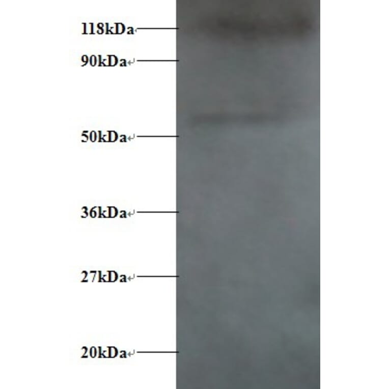 Alpha-synuclein Polyclonal Antibody from Signalway Antibody (42472) - Antibodies.com