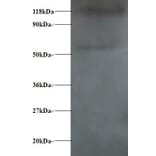 Alpha-synuclein Polyclonal Antibody from Signalway Antibody (42472) - Antibodies.com
