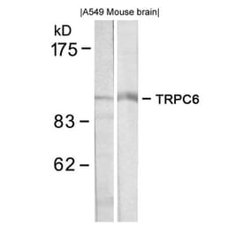 Western blot - TRPC6 Antibody from Signalway Antibody (21403) - Antibodies.com