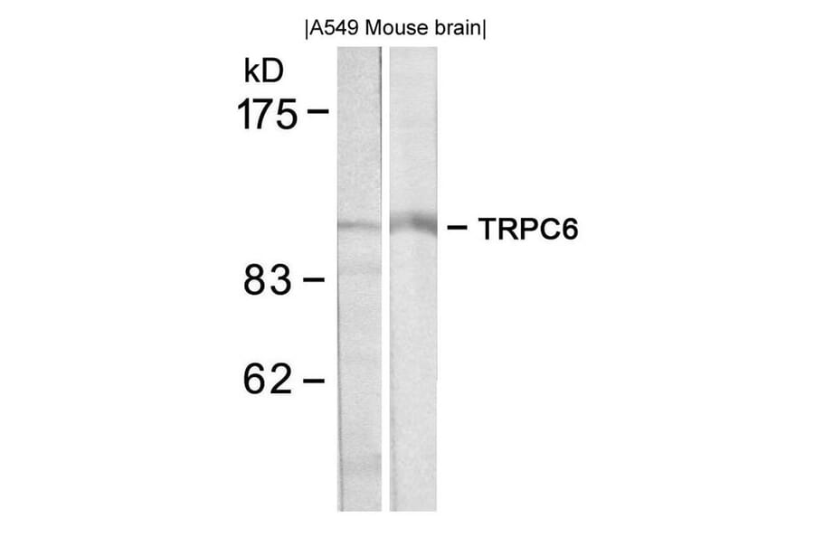 Western blot - TRPC6 Antibody from Signalway Antibody (21403) - Antibodies.com