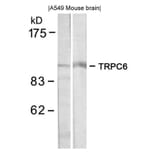 Western blot - TRPC6 Antibody from Signalway Antibody (21403) - Antibodies.com