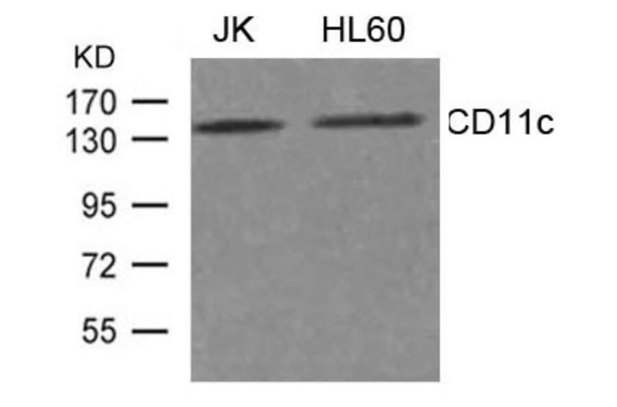 Western blot - CD11c Antibody from Signalway Antibody (21491) - Antibodies.com