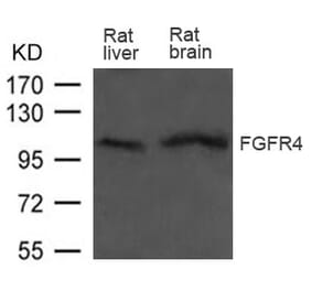 Western blot - FGFR4 Antibody from Signalway Antibody (21606) - Antibodies.com