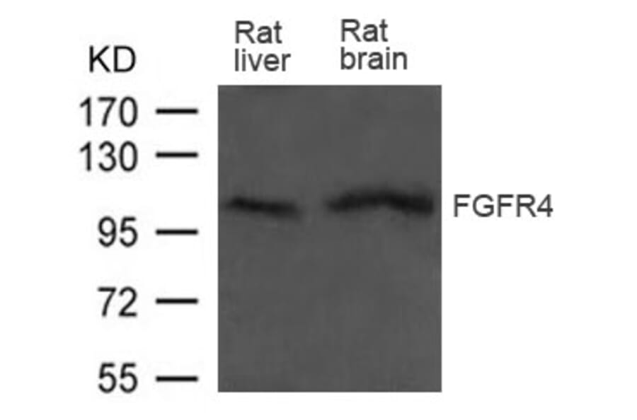Western blot - FGFR4 Antibody from Signalway Antibody (21606) - Antibodies.com