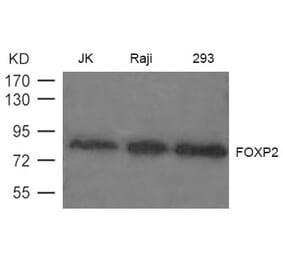 Western blot - FOXP2 Antibody from Signalway Antibody (21608) - Antibodies.com