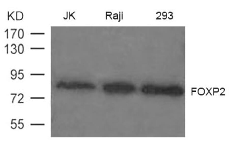 Western blot - FOXP2 Antibody from Signalway Antibody (21608) - Antibodies.com