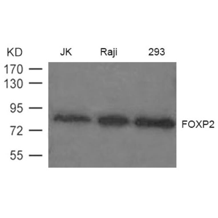Western blot - FOXP2 Antibody from Signalway Antibody (21608) - Antibodies.com