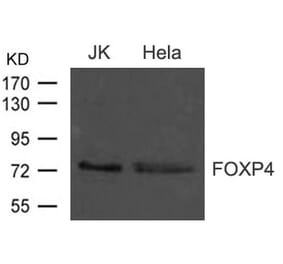 Western blot - FOXP4 Antibody from Signalway Antibody (21609) - Antibodies.com