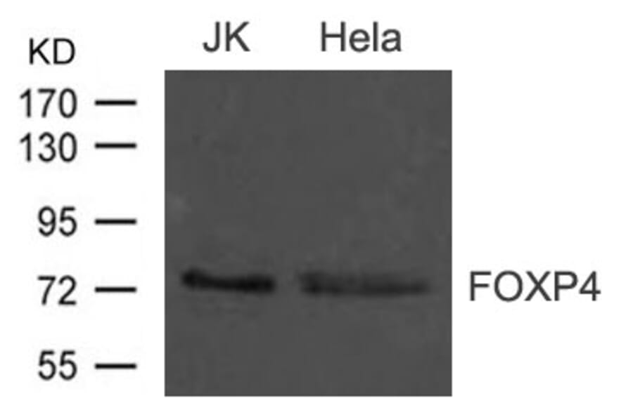 Western blot - FOXP4 Antibody from Signalway Antibody (21609) - Antibodies.com