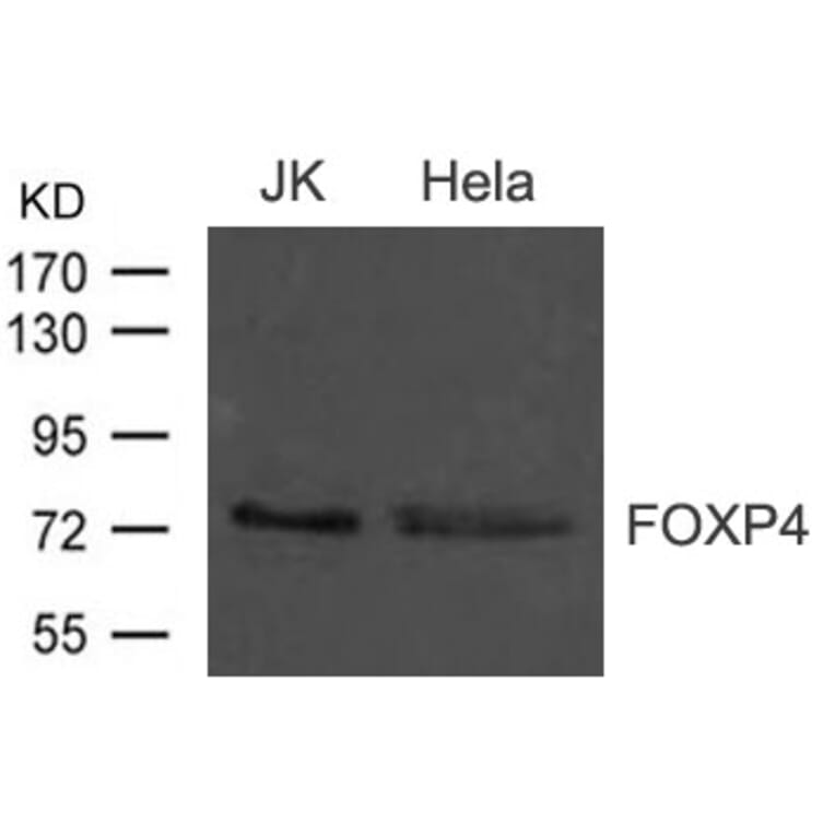 Western blot - FOXP4 Antibody from Signalway Antibody (21609) - Antibodies.com