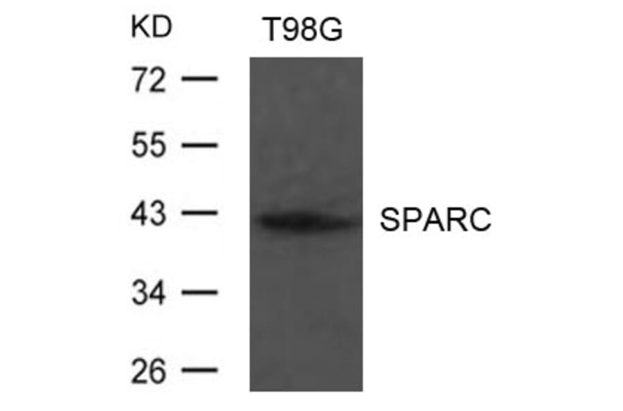 Western blot - SPARC Antibody from Signalway Antibody (21633) - Antibodies.com