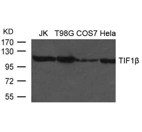 Western blot - TIF1b Antibody from Signalway Antibody (21635) - Antibodies.com
