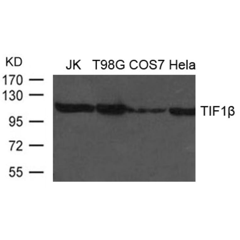 Western blot - TIF1b Antibody from Signalway Antibody (21635) - Antibodies.com