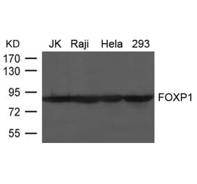 Western blot - FOXP1 Antibody from Signalway Antibody (21637) - Antibodies.com