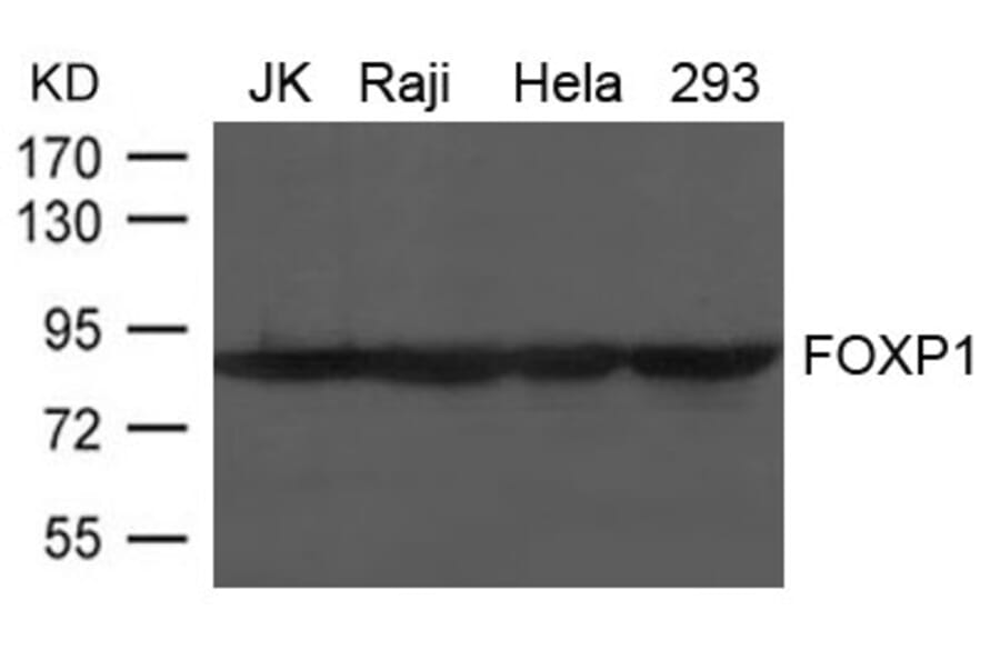 Western blot - FOXP1 Antibody from Signalway Antibody (21637) - Antibodies.com