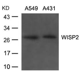 Western blot - WISP2 Antibody from Signalway Antibody (21668) - Antibodies.com