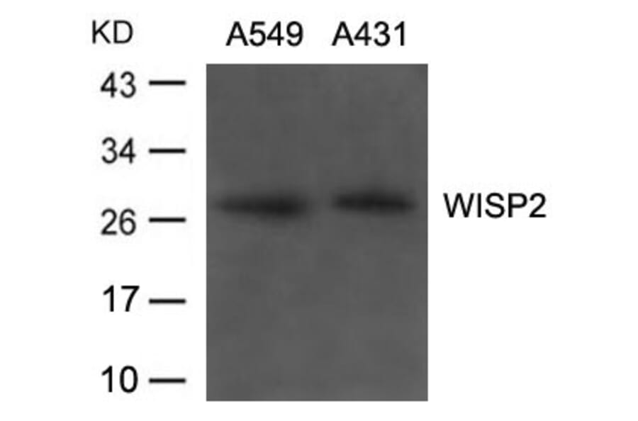 Western blot - WISP2 Antibody from Signalway Antibody (21668) - Antibodies.com