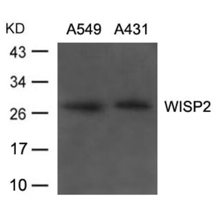 Western blot - WISP2 Antibody from Signalway Antibody (21668) - Antibodies.com