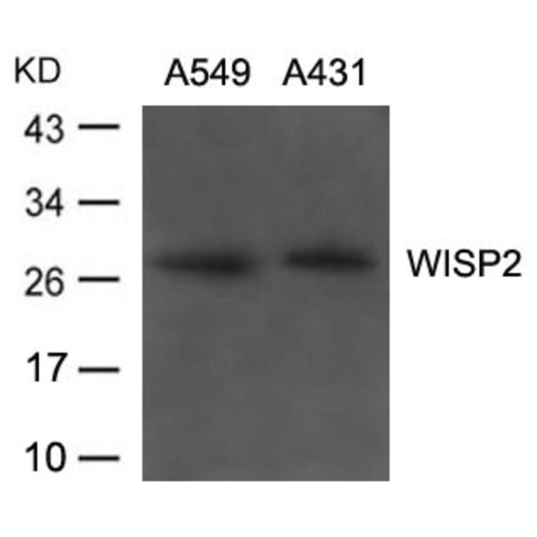 Western blot - WISP2 Antibody from Signalway Antibody (21668) - Antibodies.com