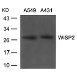 Western blot - WISP2 Antibody from Signalway Antibody (21668) - Antibodies.com