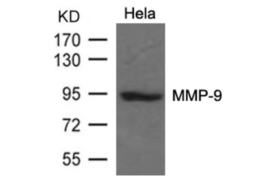 Western blot - MMP-9 Antibody from Signalway Antibody (21677) - Antibodies.com