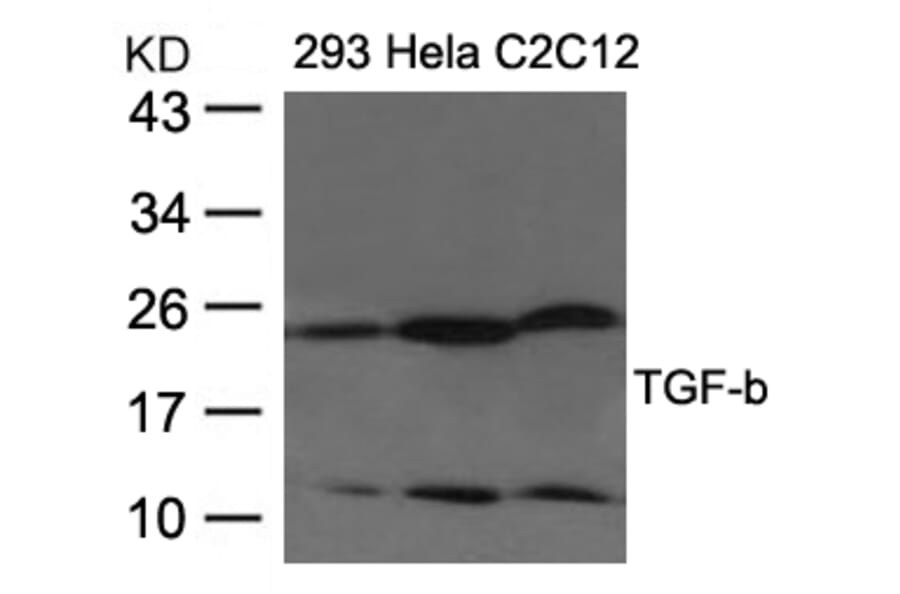Western blot - TGF-b Antibody from Signalway Antibody (21678) - Antibodies.com