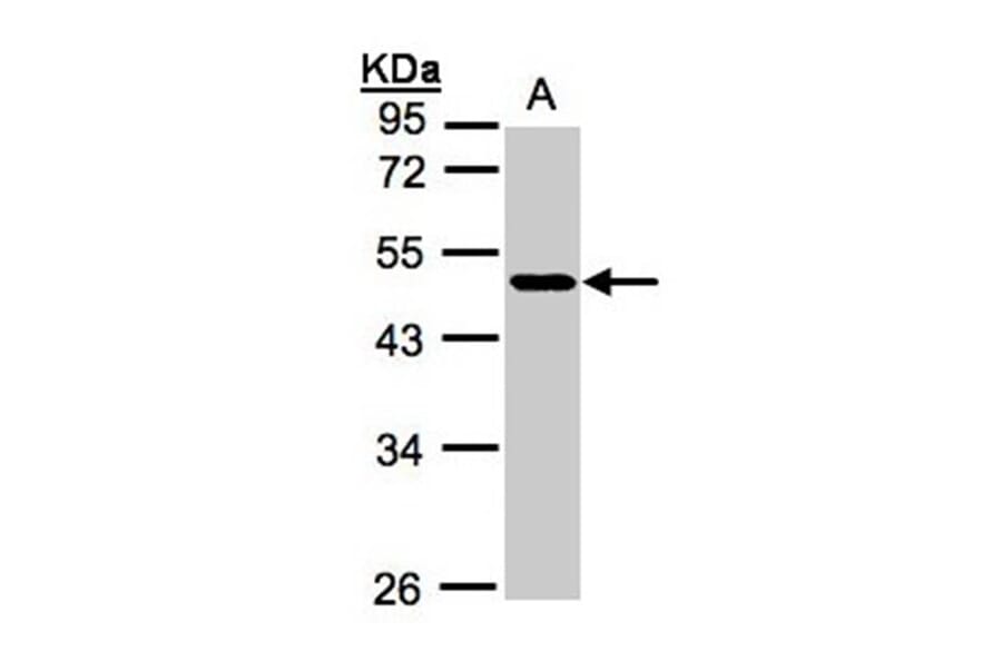 NEGR1 antibody from Signalway Antibody (22049) - Antibodies.com