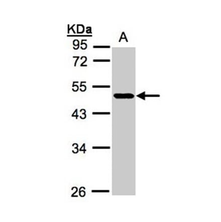 NEGR1 antibody from Signalway Antibody (22049) - Antibodies.com