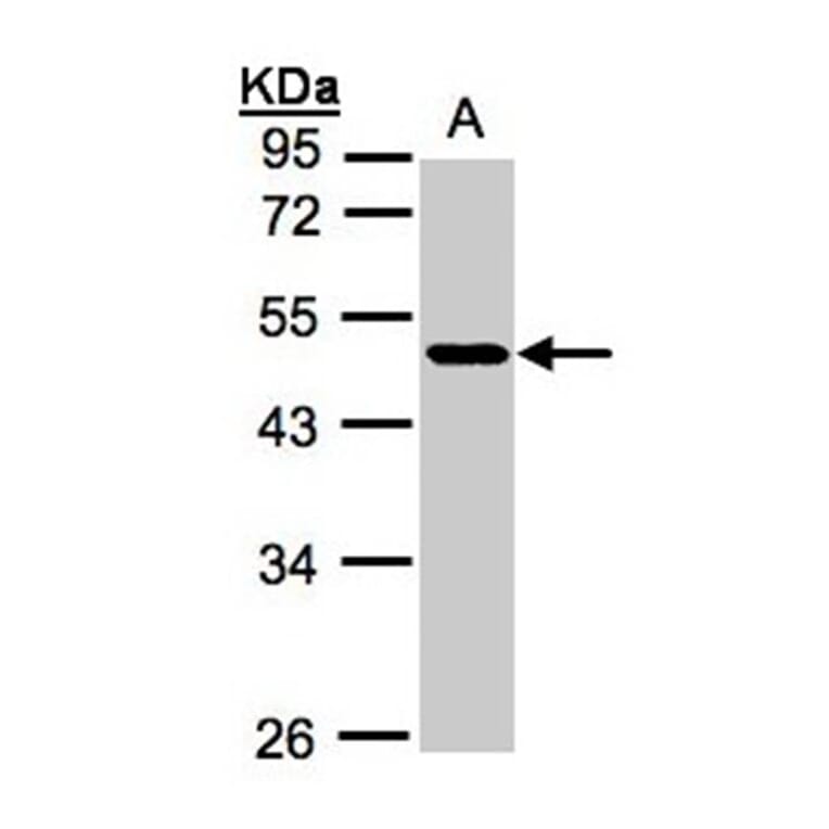 NEGR1 antibody from Signalway Antibody (22049) - Antibodies.com