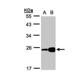 ILBP antibody from Signalway Antibody (22087) - Antibodies.com