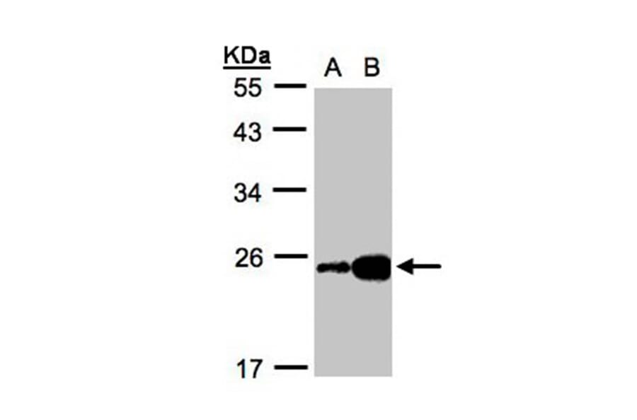 ILBP antibody from Signalway Antibody (22087) - Antibodies.com