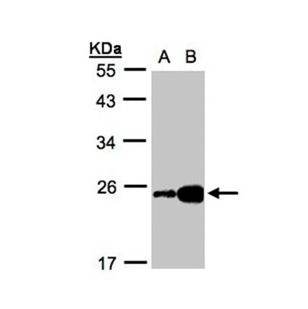 ILBP antibody from Signalway Antibody (22087) - Antibodies.com