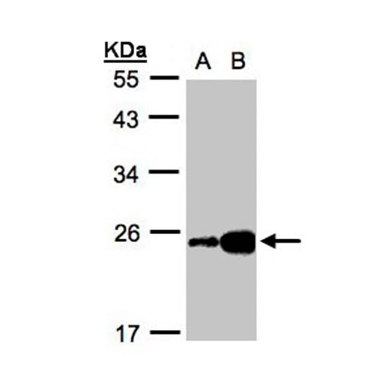 ILBP antibody from Signalway Antibody (22087) - Antibodies.com