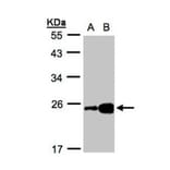 ILBP antibody from Signalway Antibody (22087) - Antibodies.com