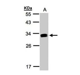 GILT antibody from Signalway Antibody (22109) - Antibodies.com