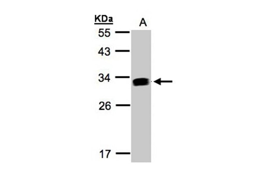 GILT antibody from Signalway Antibody (22109) - Antibodies.com