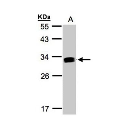 GILT antibody from Signalway Antibody (22109) - Antibodies.com
