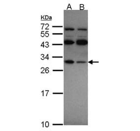 RPS4X antibody from Signalway Antibody (22132) - Antibodies.com