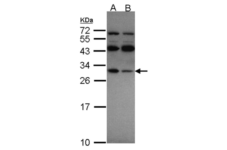 RPS4X antibody from Signalway Antibody (22132) - Antibodies.com