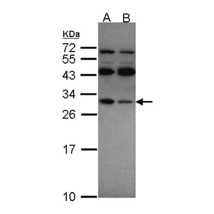 RPS4X antibody from Signalway Antibody (22132) - Antibodies.com