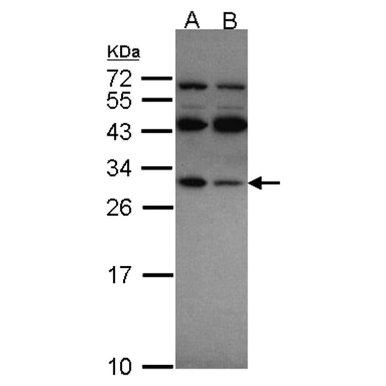 RPS4X antibody from Signalway Antibody (22132) - Antibodies.com