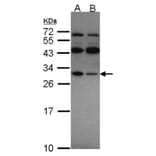 RPS4X antibody from Signalway Antibody (22132) - Antibodies.com