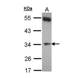 b5R.1 antibody from Signalway Antibody (22156) - Antibodies.com