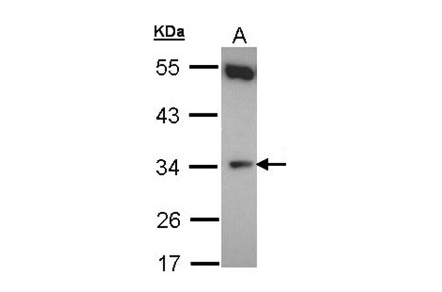 b5R.1 antibody from Signalway Antibody (22156) - Antibodies.com