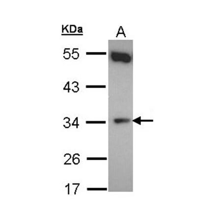 b5R.1 antibody from Signalway Antibody (22156) - Antibodies.com