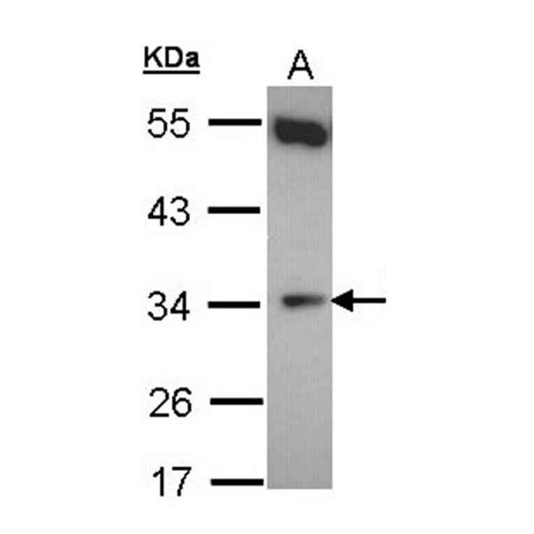 b5R.1 antibody from Signalway Antibody (22156) - Antibodies.com