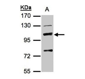 MANBA antibody from Signalway Antibody (22166) - Antibodies.com