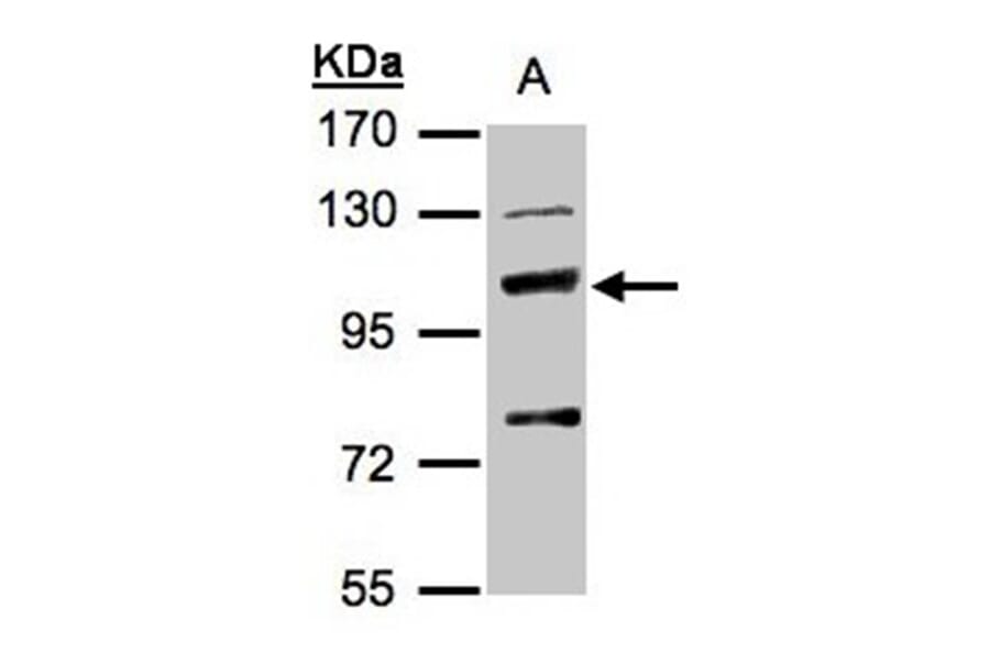 MANBA antibody from Signalway Antibody (22166) - Antibodies.com
