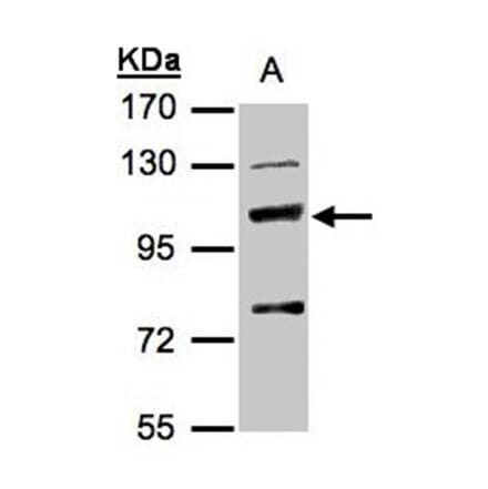 MANBA antibody from Signalway Antibody (22166) - Antibodies.com